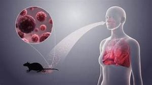 Un muerto por hantavirus en Bariloche