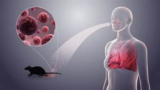 Un muerto por hantavirus en Bariloche