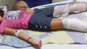 Dos niños heridos luego que detonara un artefacto explosivo que llevaron a su casa desde un basural