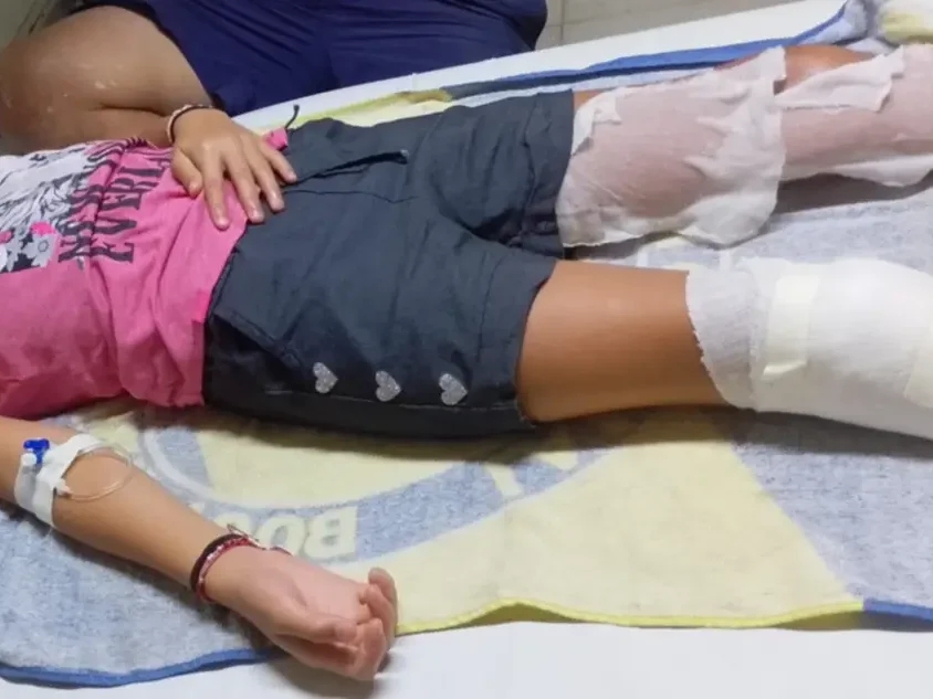 Dos niños heridos luego que detonara un artefacto explosivo que llevaron a su casa desde un basural