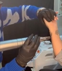 (video)En su Centro de Estética Monísima,  Vanesa Dupuy borra tatuajes con láser