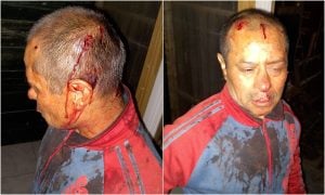 Bahía: Fue a arreglar una persiana y lo descubrieron masturbándose con la bombacha de la inquilina