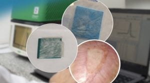 (audio) Innovado tratamiento médico CONICET aplica vendas de placenta para curar heridas en sus pacientes