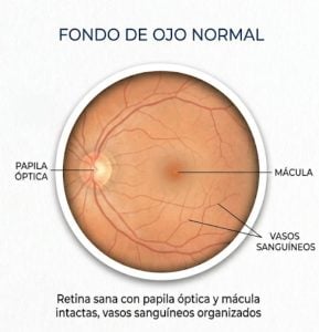Cuidar la mirada de nuestros mayores: ¿Qué es la maculopatía seca y cómo detectarla a tiempo?