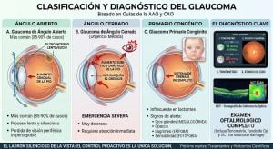 No todos los glaucomas son iguales: Tipos, síntomas ocultos y el diagnóstico clave